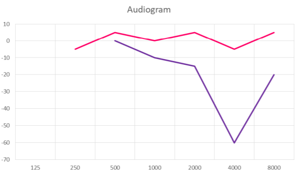 Can You Hear Me Audiogram